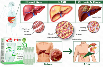 𝑪𝒂𝒏𝒂𝒅𝒂'𝒔 𝑫𝒐𝒄𝒕𝒐𝒓-𝑹𝒆𝒄𝒐𝒎𝒎𝒆𝒏𝒅𝒆𝒅 | 𝙇𝙤𝙩𝙢𝙖𝙮® 𝖦𝑳𝖯-1 𝑴𝒆𝒕𝒂𝒃𝒐𝒍𝒊𝒄 𝑩𝒂𝒍𝒂𝒏𝒄𝒆 𝑶𝒓𝒂𝒍 𝑨𝒎𝒑𝒐𝒖𝒍𝒆𝒔 –𝟏𝐱/𝐝𝐚𝐲, 𝐯𝐢𝐬𝐢𝐛𝐥𝐞 𝐫𝐞𝐬𝐮𝐥𝐭𝐬 𝐢𝐧 𝟕 𝐝𝐚𝐲𝐬 👑 𝐒𝐮𝐩𝐩𝐨𝐫𝐭𝐬 𝐰𝐞𝐢𝐠𝐡𝐭 𝐦𝐚𝐧𝐚𝐠𝐞𝐦𝐞𝐧𝐭, 𝐡𝐞𝐚𝐫𝐭 𝐡𝐞𝐚𝐥𝐭𝐡, 𝐝𝐢𝐚𝐛𝐞𝐭𝐞𝐬, 𝐬𝐥𝐞𝐞𝐩, 𝐝𝐢𝐠𝐞𝐬𝐭𝐢𝐨𝐧, 𝐚𝐧𝐝 𝐣𝐨𝐢𝐧𝐭 𝐡𝐞𝐚𝐥𝐭𝐡 🍃